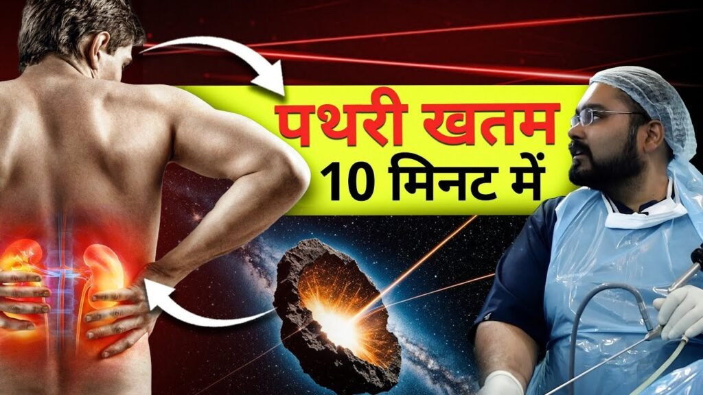 Remove Kidney Stones in 15 Minutes: The Kidney Stone Laser Surgery
